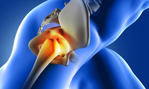 x-ray image with hip highlighted