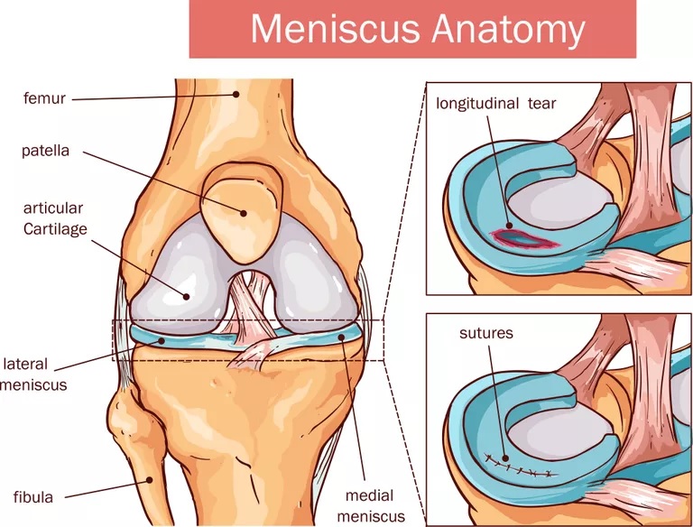 diagram of ligaments, cartilage, and meniscus