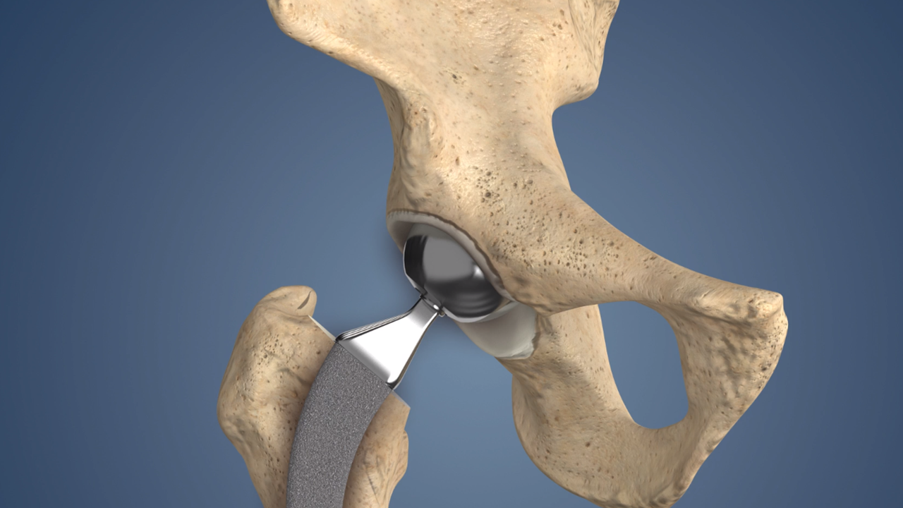 X-ray image of highlighted kneecaps